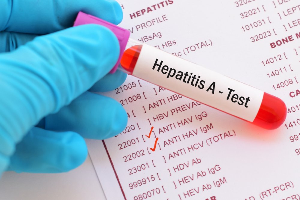 Hepatit: Qaraciyəri Necə Qoruyaq